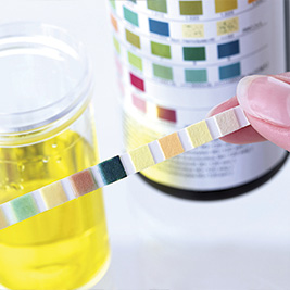 Urine staal 