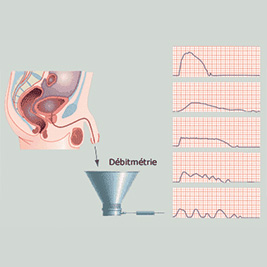 Debietmeting 