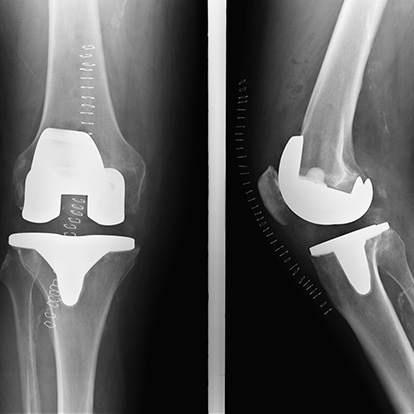 Radiografische controle