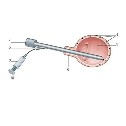 Injectie van Botox in de blaas 