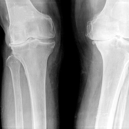 Radiografie 