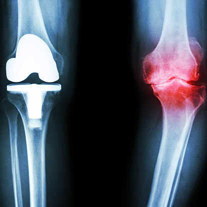Radiografie